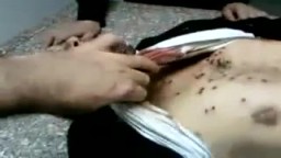 جثة شهيد مصرى قتل أمام وزارة الداخلية برصاص قوات الشرطة أثناء المظاهرات