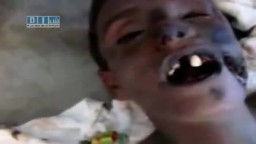 للكبار فقط سوريا : الطفل ثامر شهيد تعذيب جنود الاسد